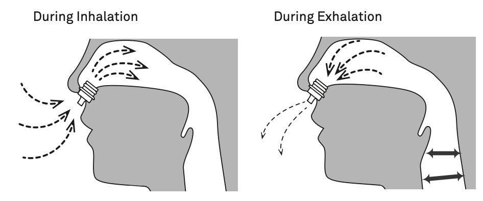 Zeepap Anti Snoring device