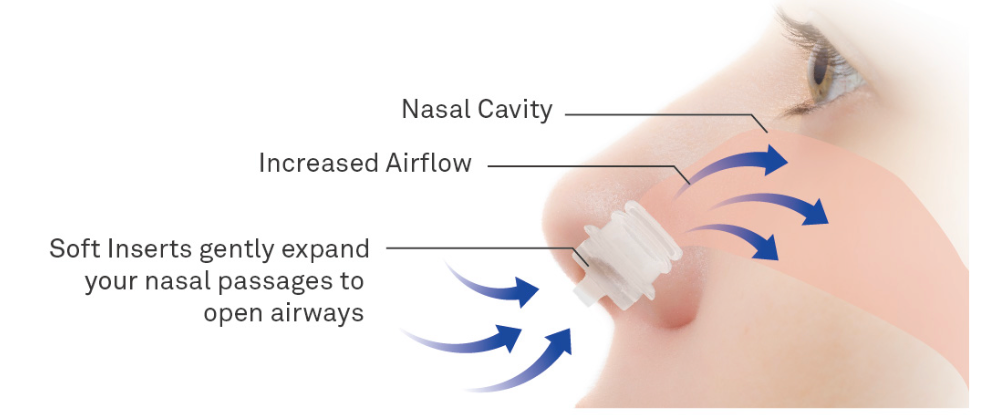 Zeebud Nasal expander